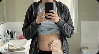 Fabricated clinical progress photo